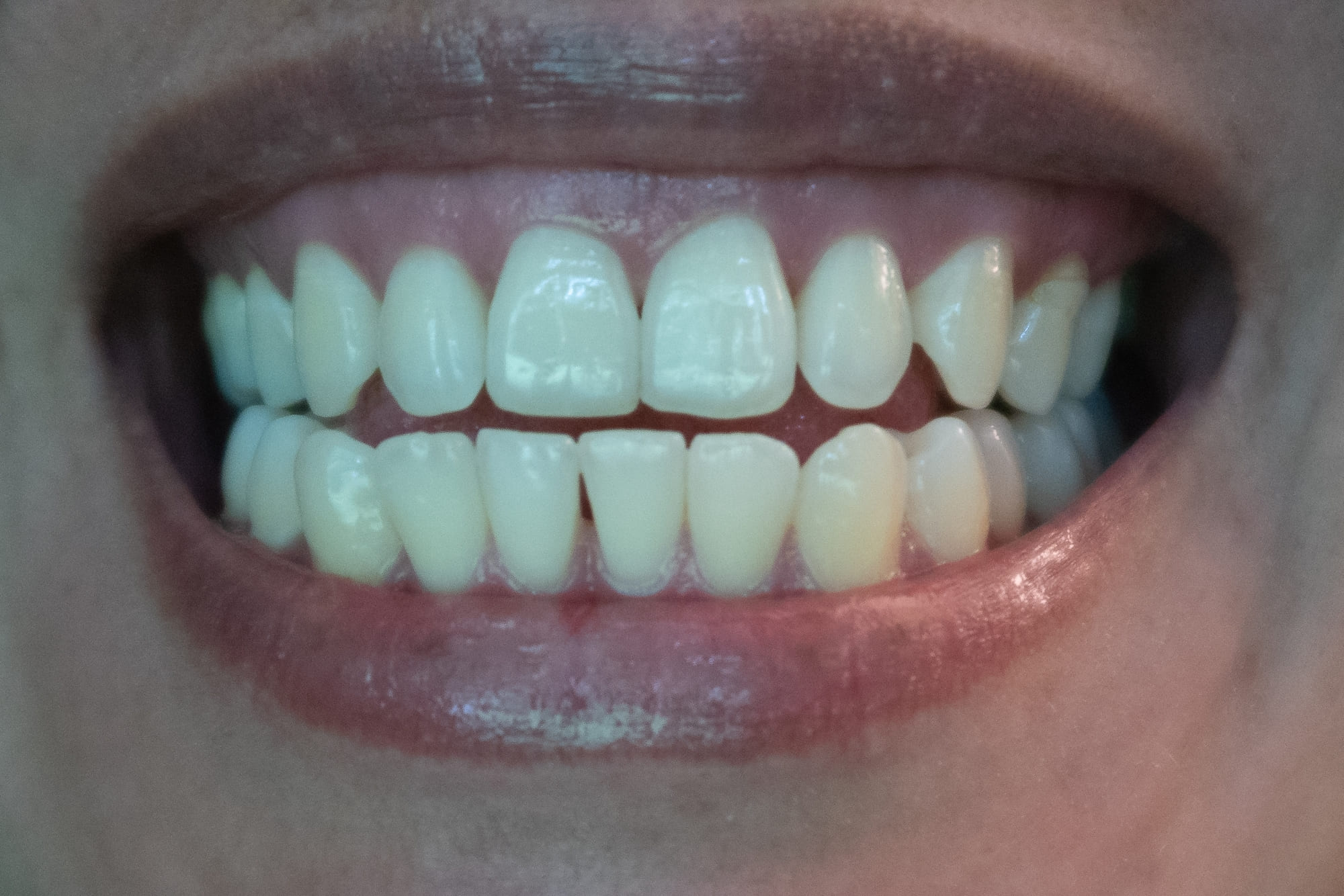 Estetica_Denta_Sonrisa
