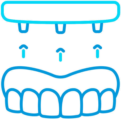 implante-dental (1)